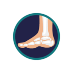 Foot or Ankle Pain
