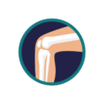 Knee pain